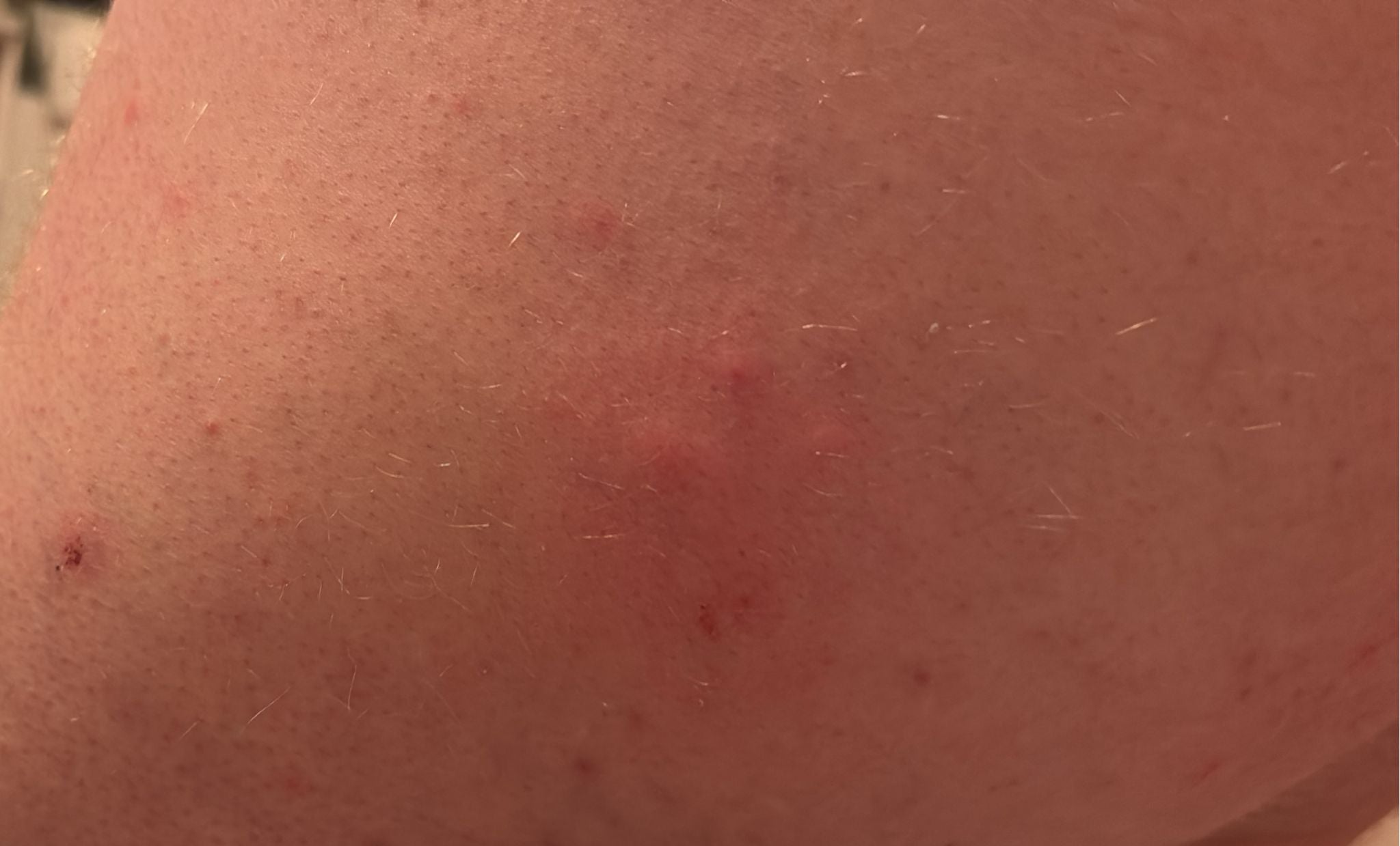 Pappataci Sandmücken, Tigermücken und Co. – was hilft